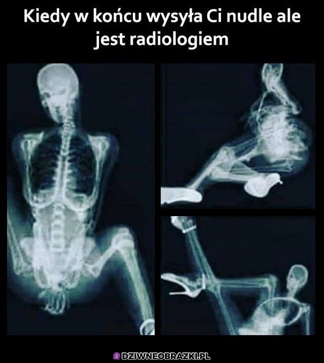 Nudle