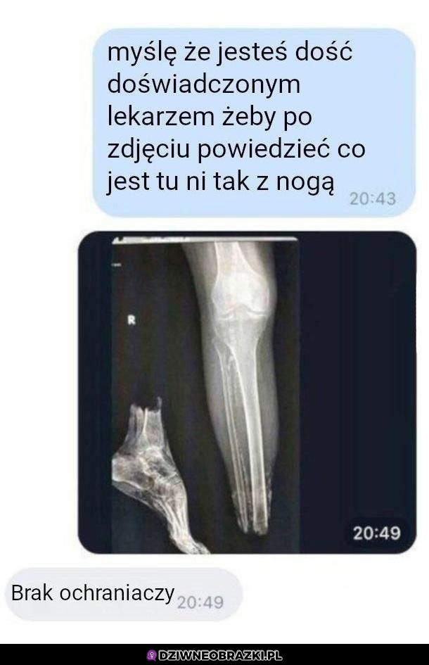 Coś nie tak z nogą