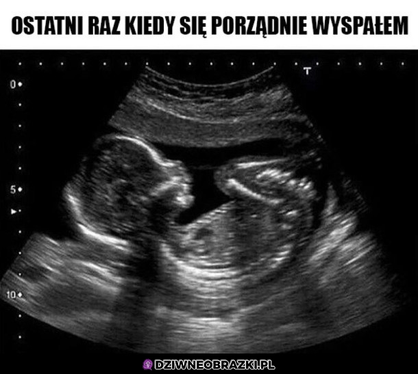 Wtedy to było