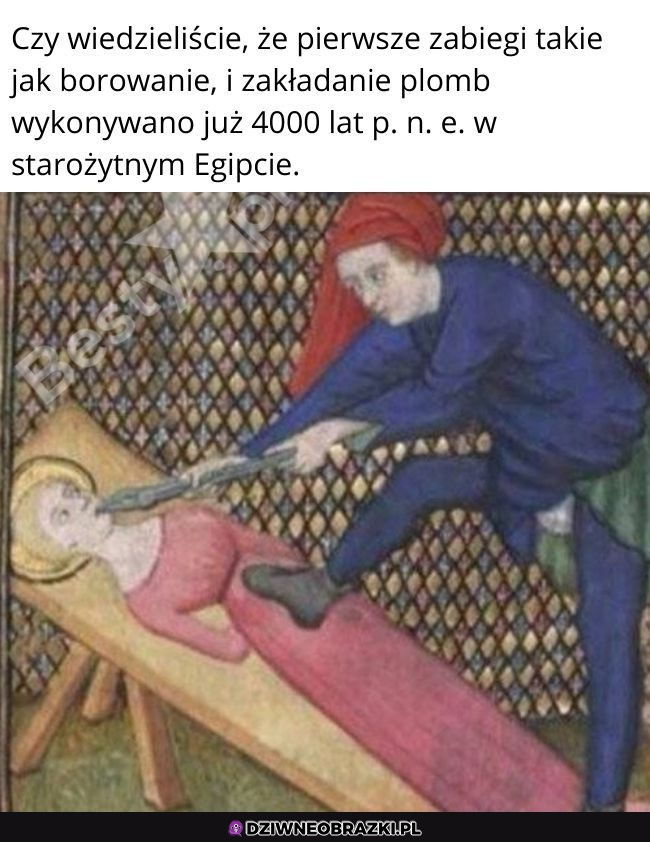 To chyba było bez znieczulenia...