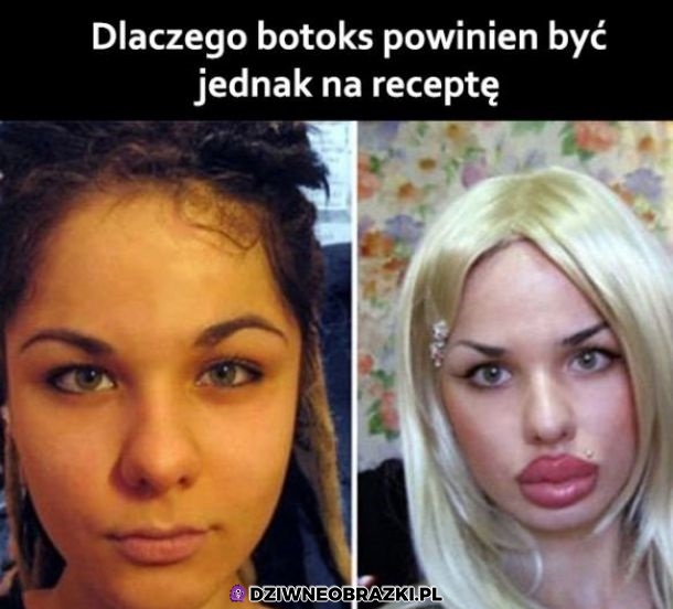 I ryj do wymiany