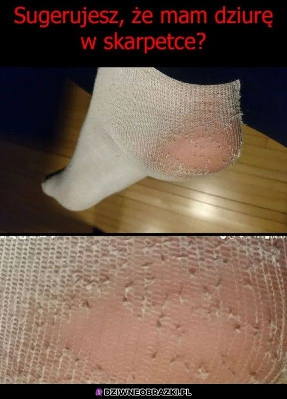 Nope, to nie dziura