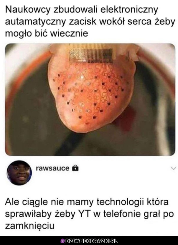 Gdzie ten postęp