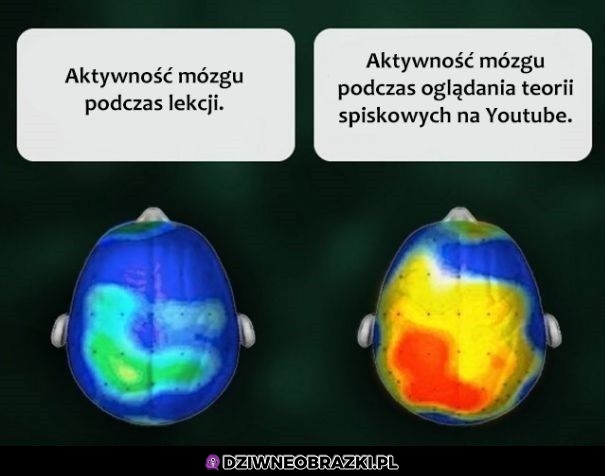 Aktywność mózgu